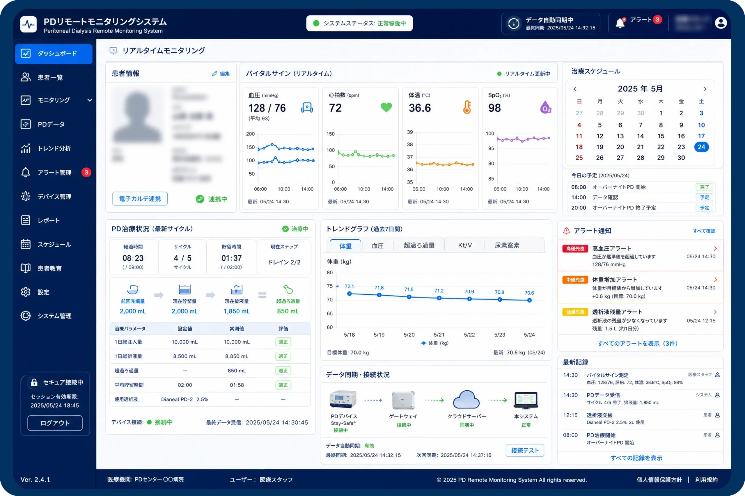 PD 腹膜透析システム