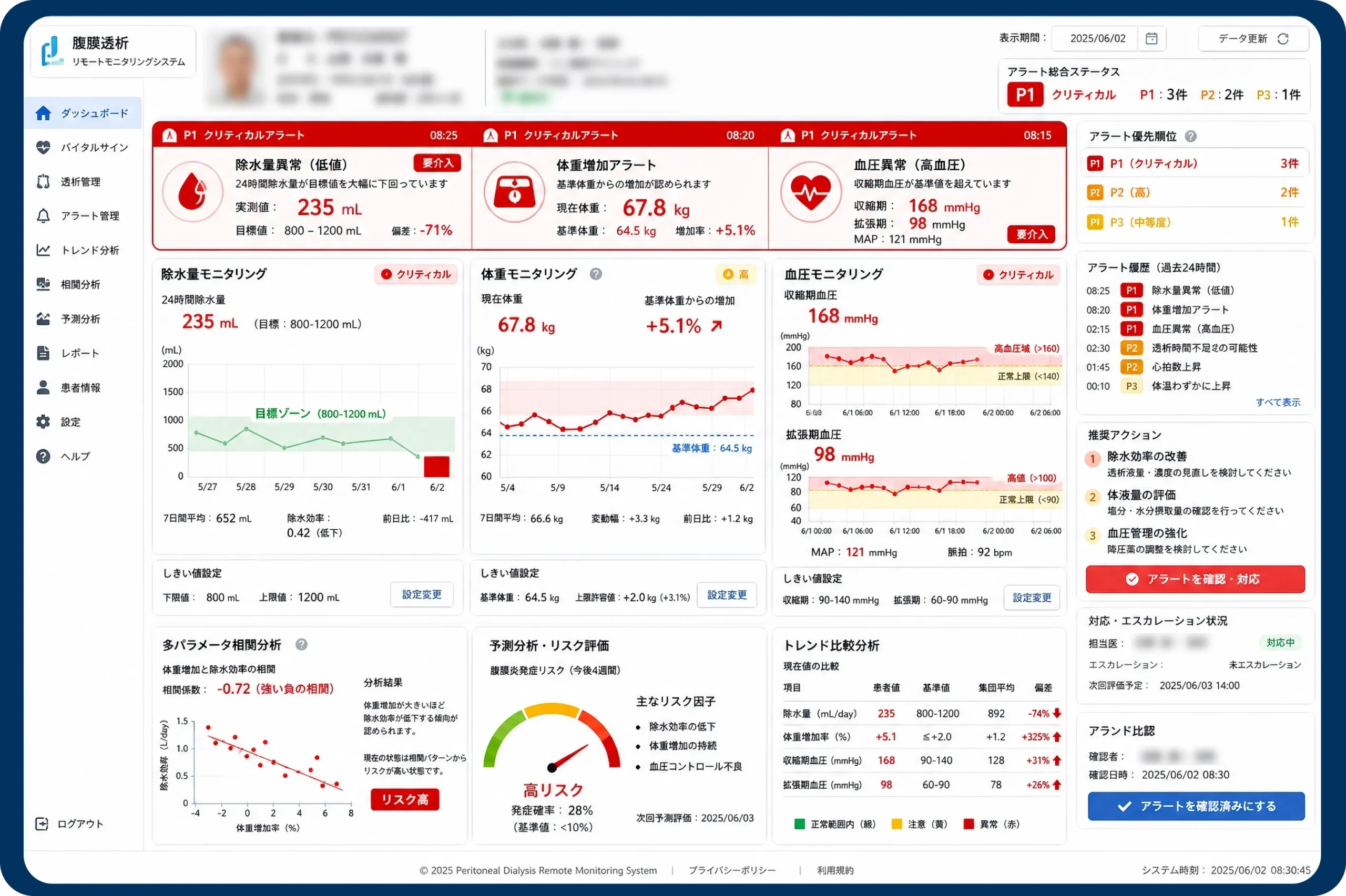 PD 腹膜透析システム