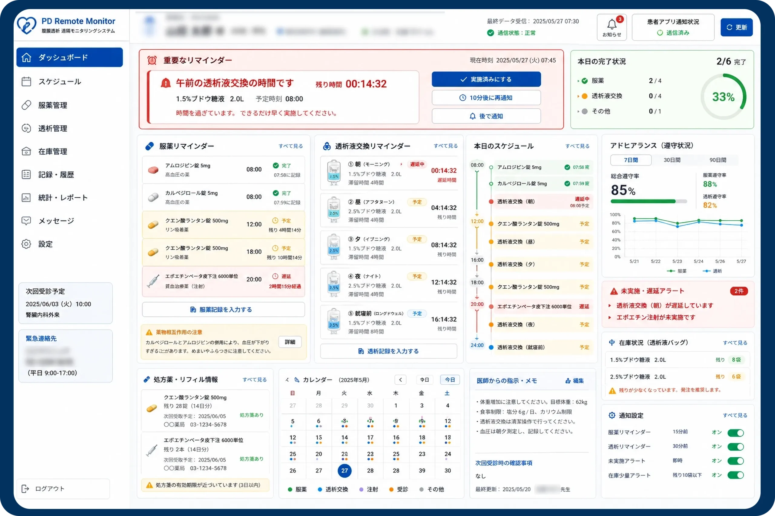 PD 腹膜透析システム
