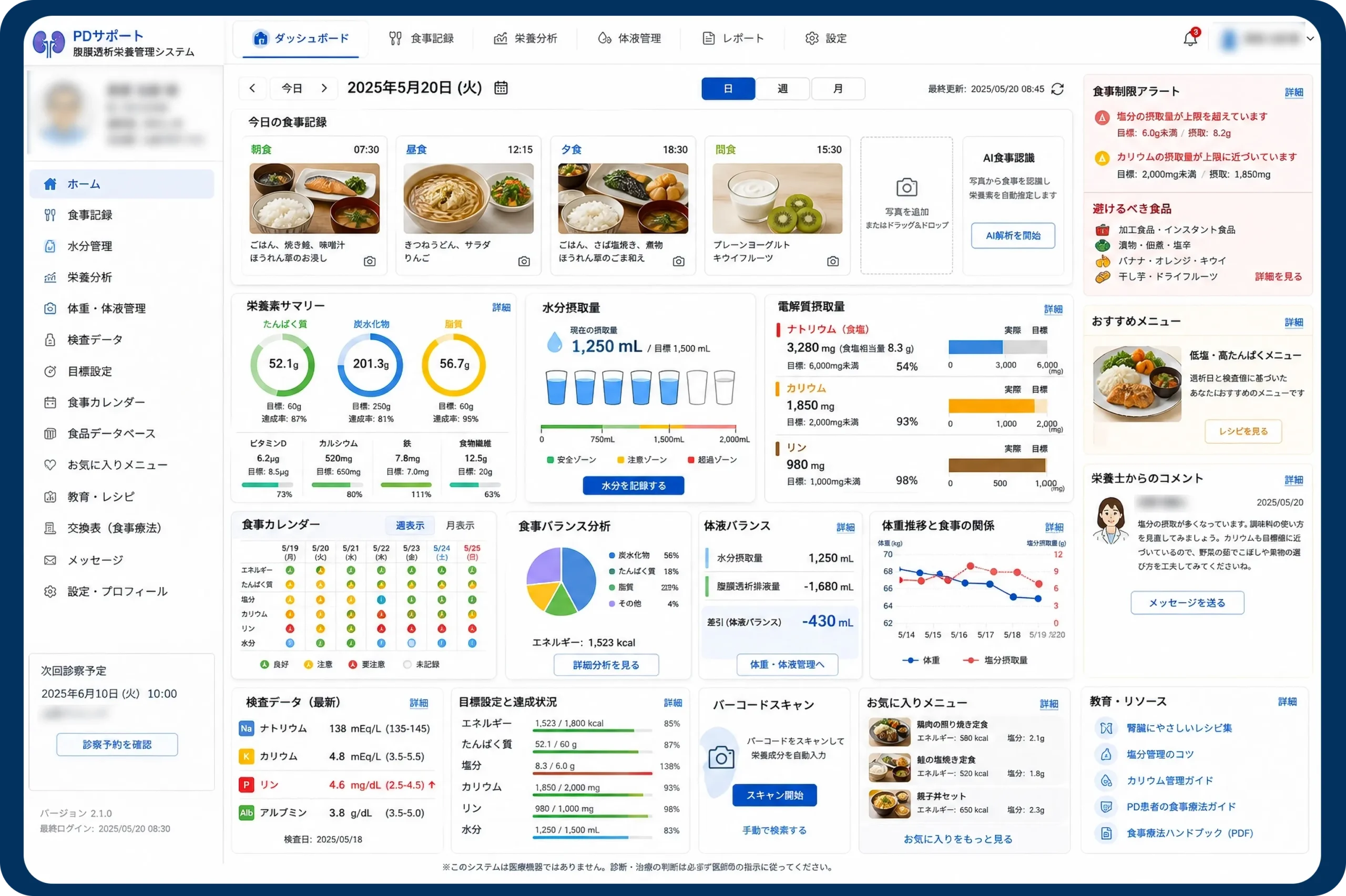 PD 腹膜透析システム