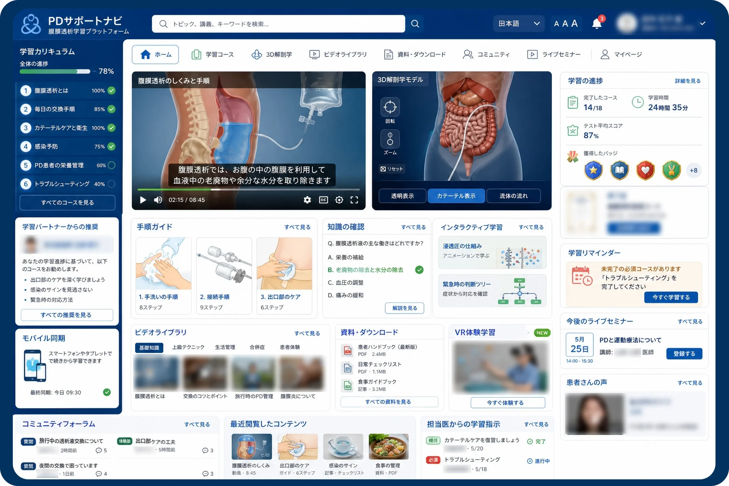 PD 腹膜透析システム
