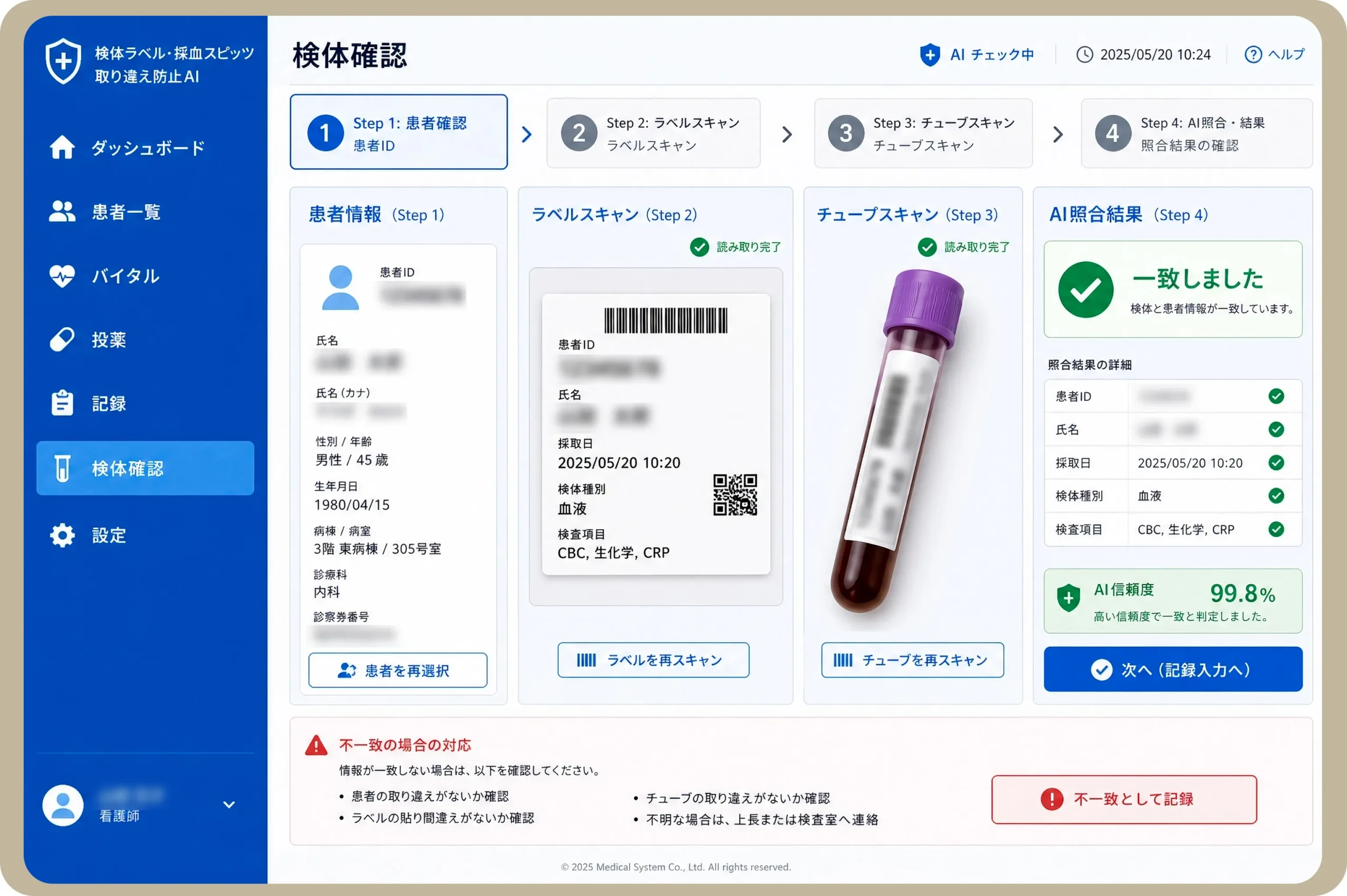 検体ラベル、採血スピッツ、取り違え防止AI